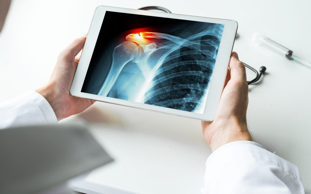 How the Growth of ASC Surgeries Impacts Coordination, Timelines and Recovery